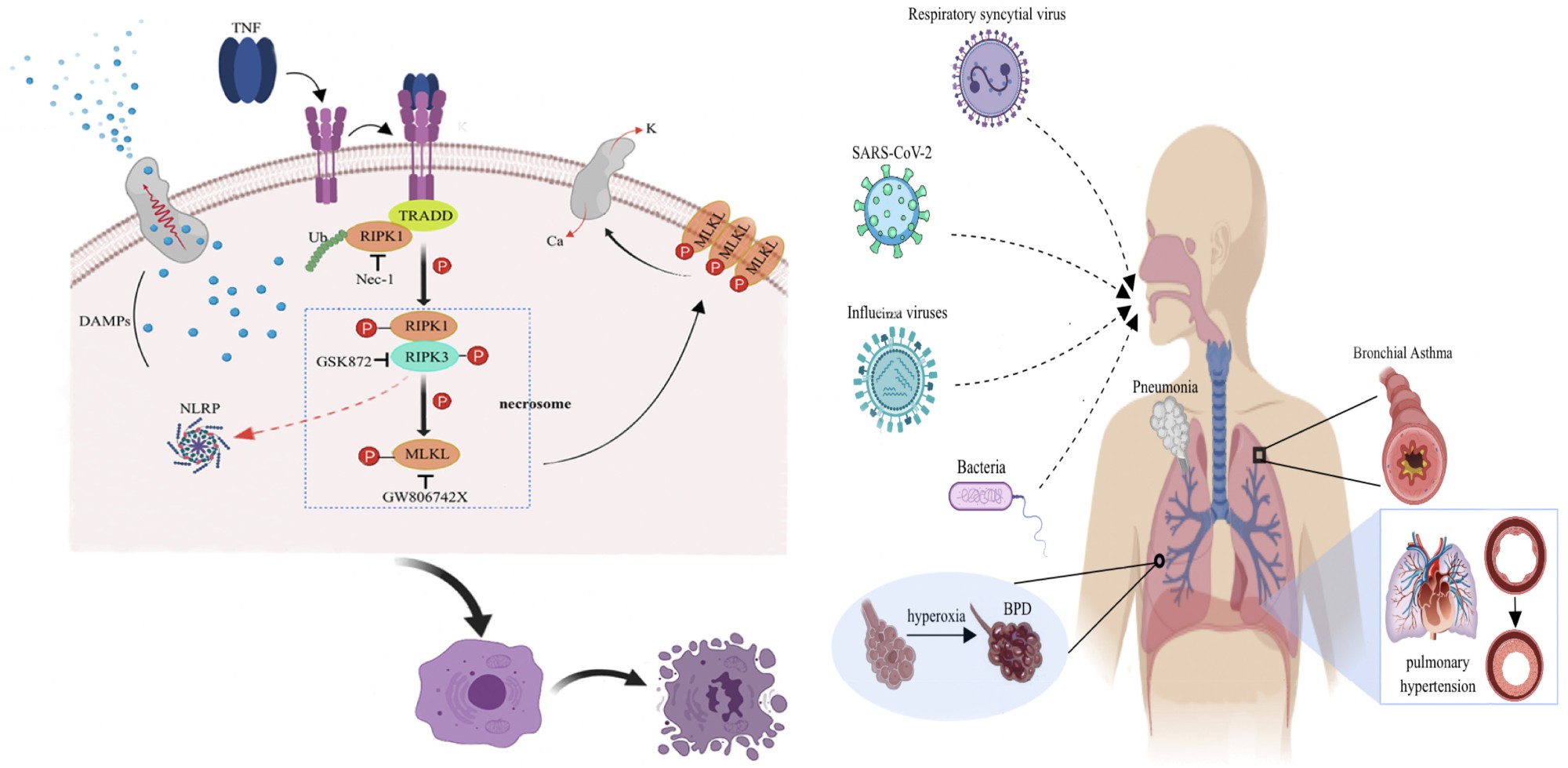 乔莉娜教授团队发表综述：The role of necroptosis in common respiratory diseases in children